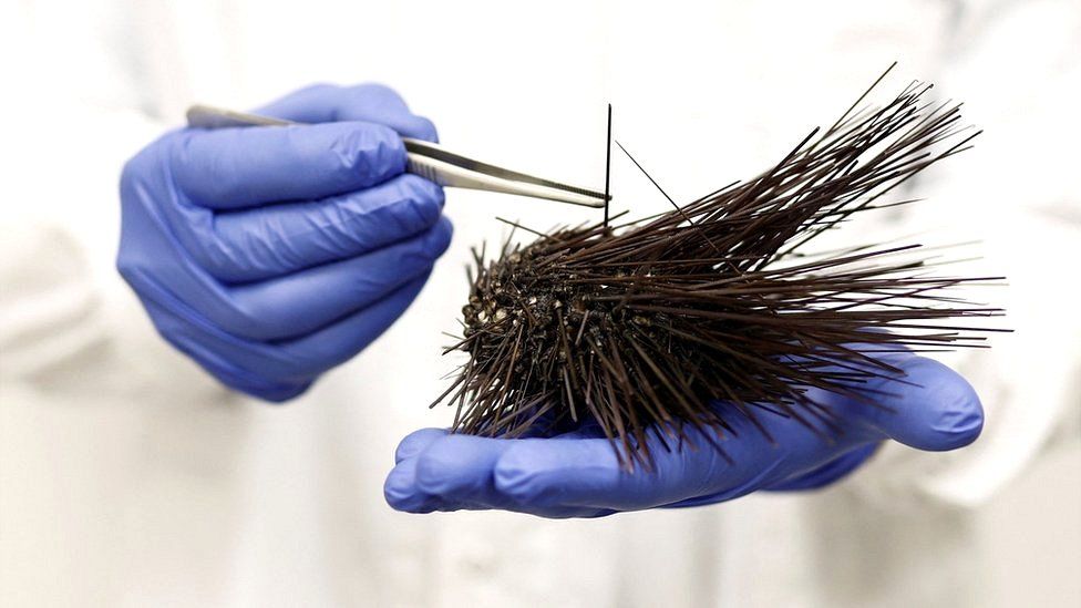 Ein Wissenschaftler untersucht mit einer Pinzette einen toten schwarzen Seeigel