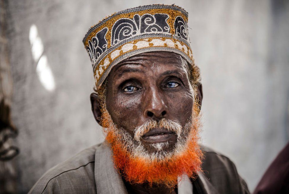 An elderly man looks directly into the camera.