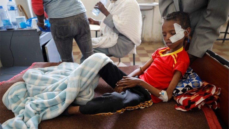 Fourteen-year-old Adan Muez is helped to sit up in his bed at Adigrat General Hospital in the town of Adigrat, Tigray region, Ethiopia, March 18, 2021