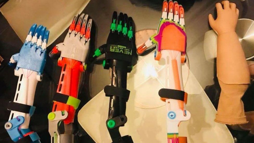 The 3D printed arms and the NHS prosthetic