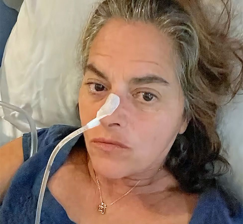 Tracey Emin with a medical tube attached to her nose