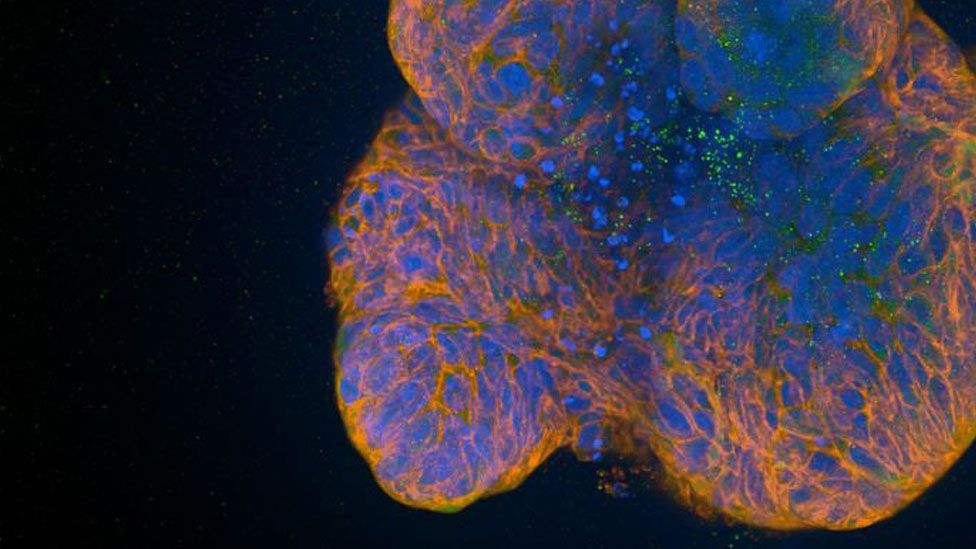 An orange blue and green "mini gut" created in a lab by Cambridge University