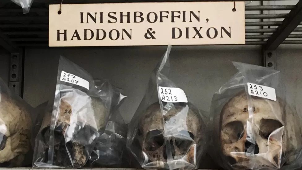 Inishbofin skulls