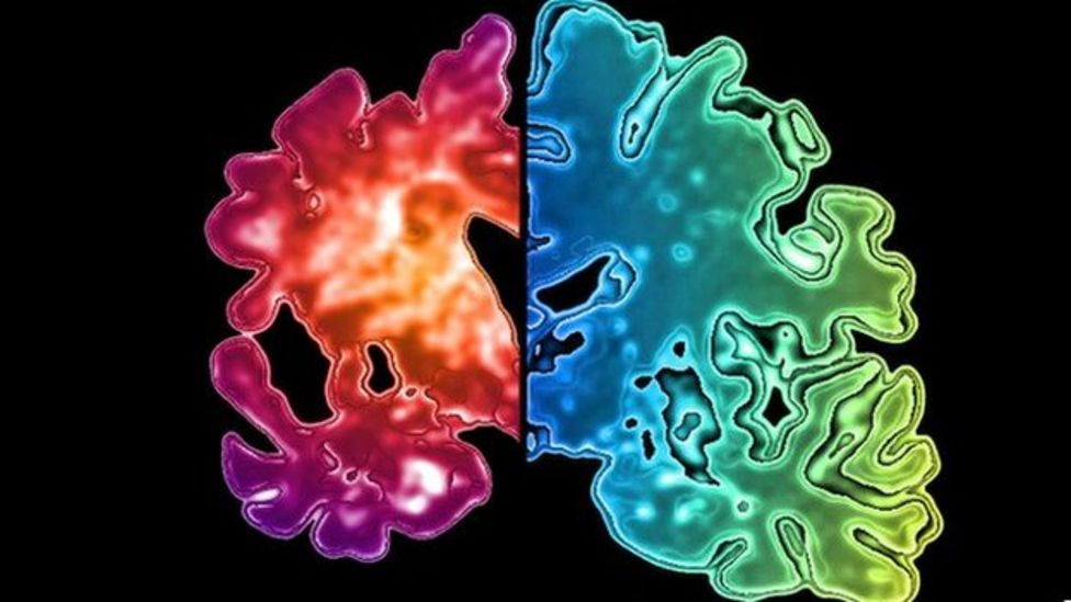 Is This The End Of Alzheimers Two Drugs Reverse Brain Damage In Mice - d9edo96