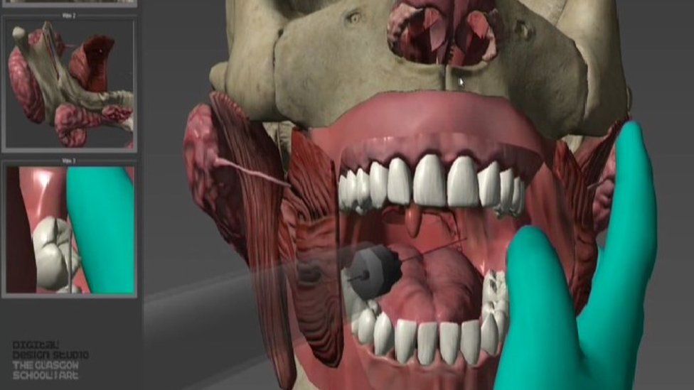 3D model used for dentistry training
