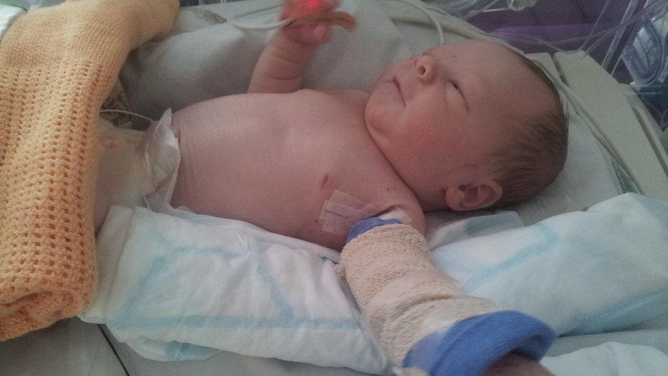 Sol in hospital hours after being born - facing amputation