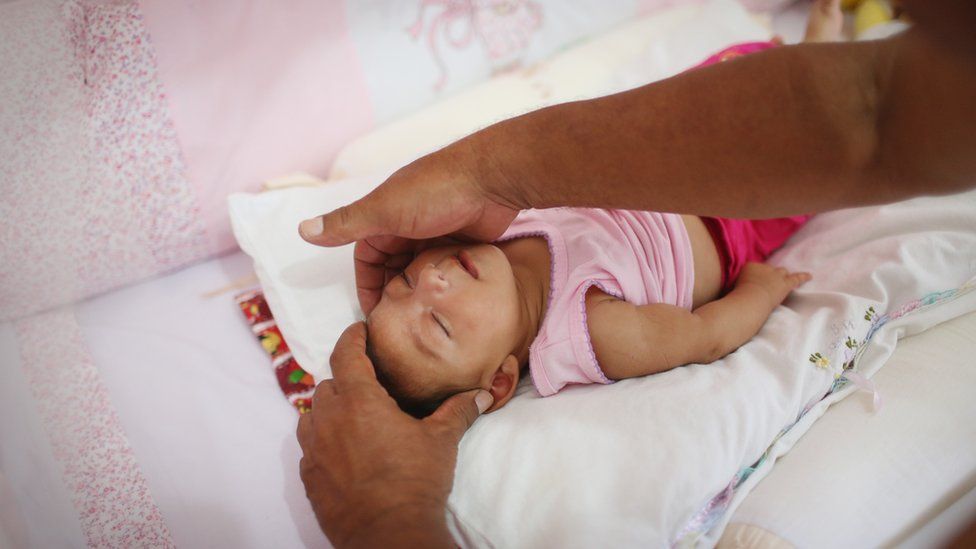 Alice Vitoria Gomes Bezerra, three months old, who has microcephaly, is placed in her crib by her father Joao Batista Bezerra in Recife, Brazil, 27 January