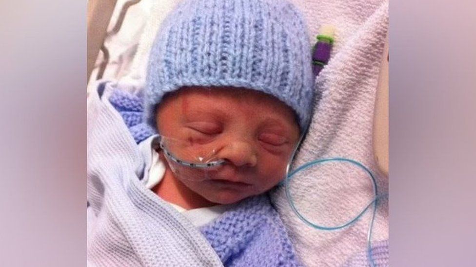 Very small baby with tube in nose wearing woolly hat
