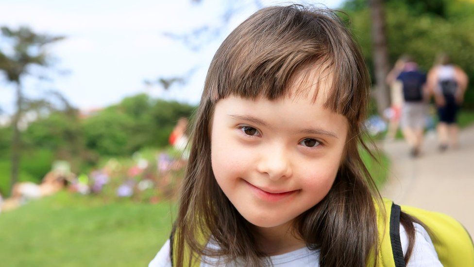 What is down syndrome?
