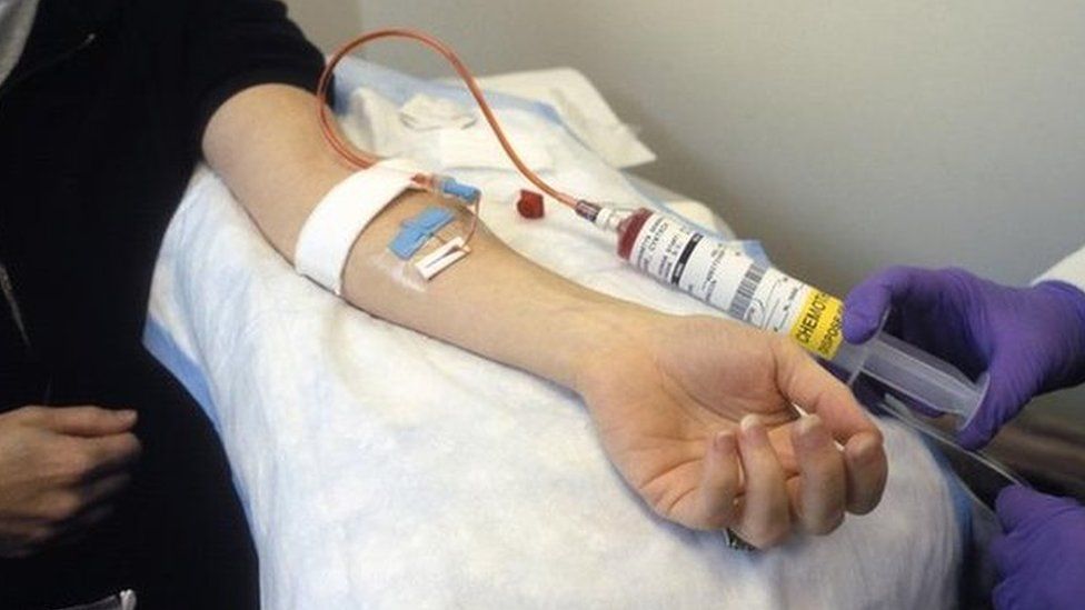 A patient receiving an intravenous dose of anticancer drugs from a syringe