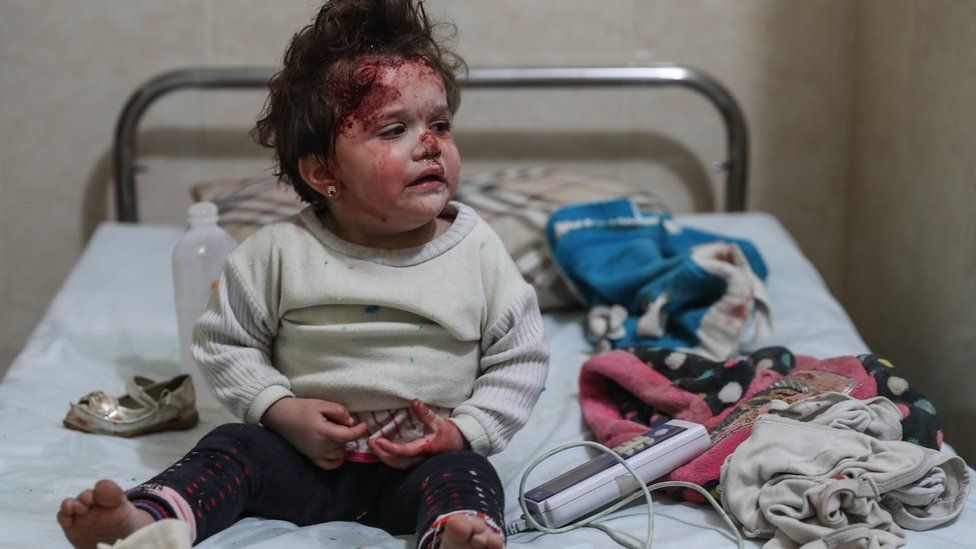 A young girl is treated at a hospital after a bombing in Mesraba, Eastern Ghouta, Syria, 3 January 2018