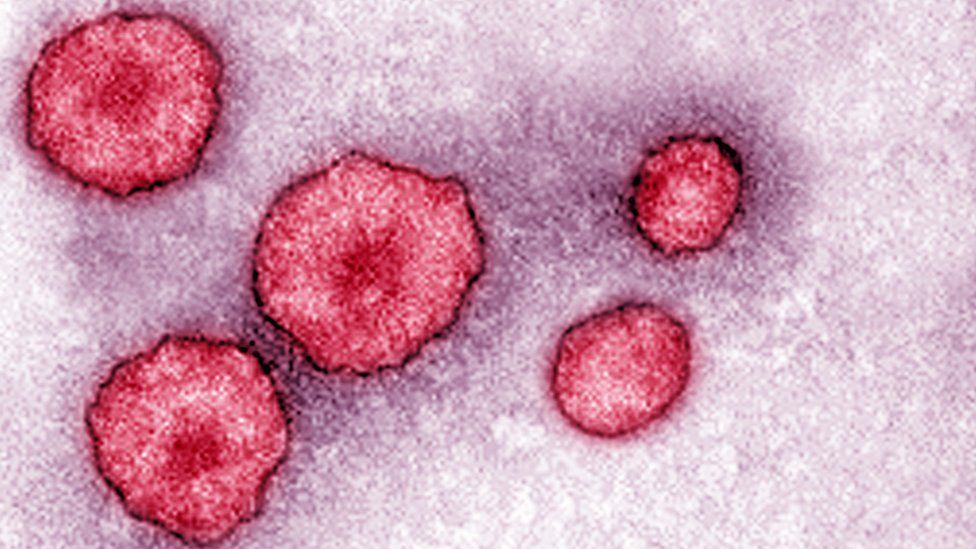 mumps virus