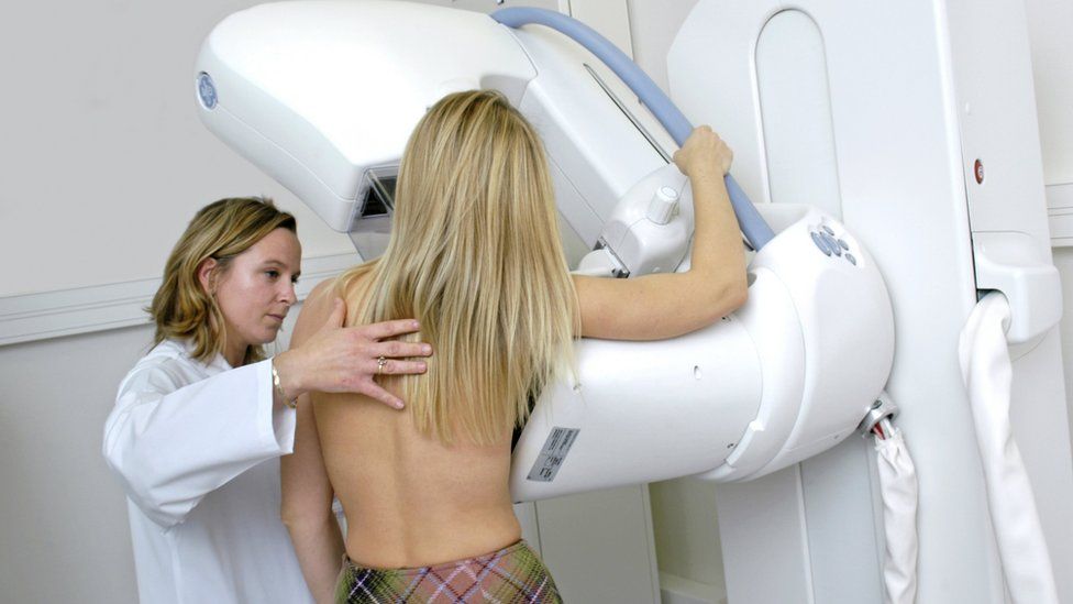 Generic picture of a woman receiving a mammogram