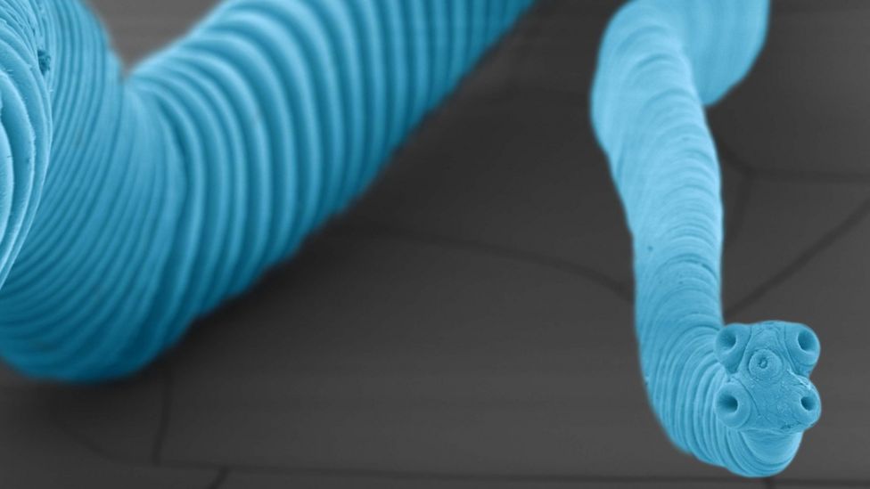 Live tapeworm pulled from California man's brain BBC News