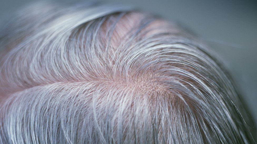 Scientists discover 'why stress turns hair white' - BBC News