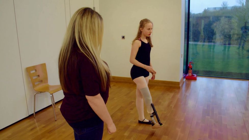 woman below knee prosthetic leg