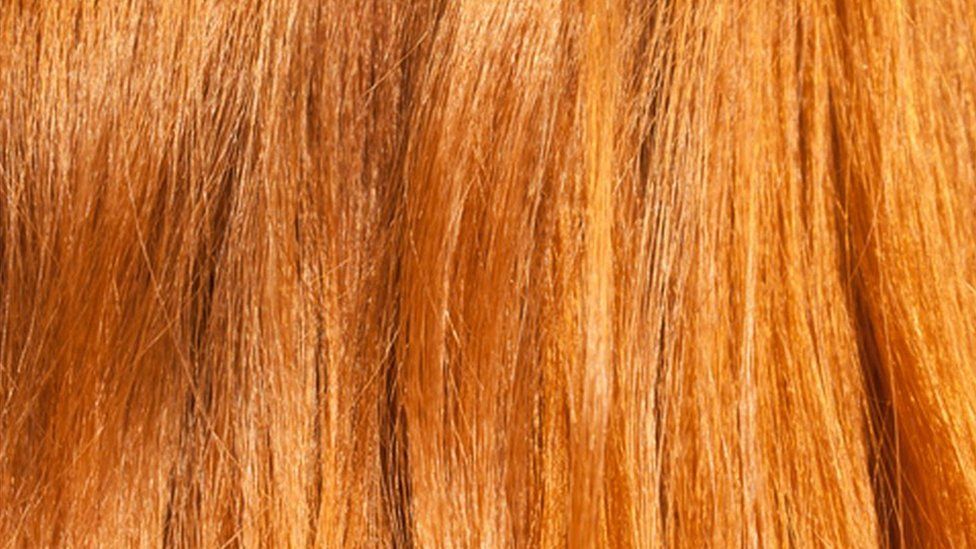 Hidden Red Hair Gene A Skin Cancer Risk Bbc News