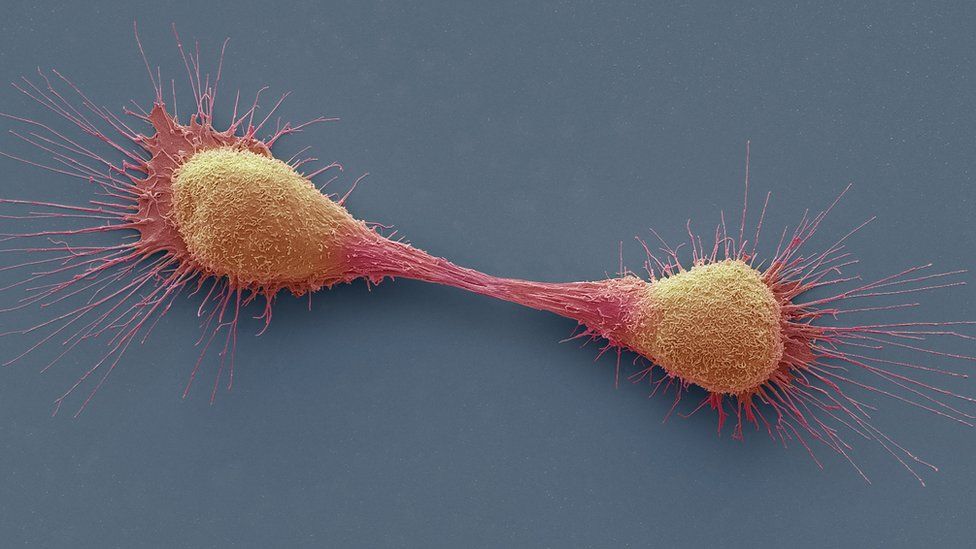 Dividing prostate cancer cells