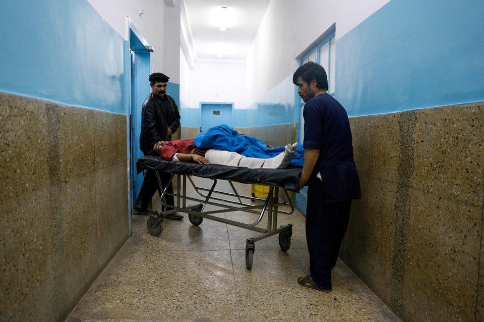 Afghan volunteer and medical staff member carry an injured man on a stretcher at Wazir Akbar Khan hospital