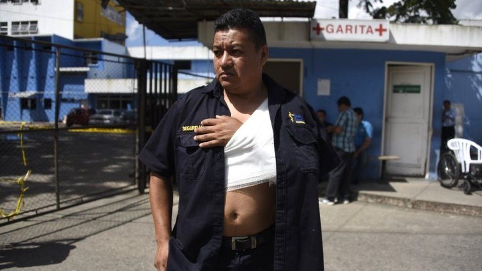 Prison guard Giovanni Aju, who was wounded during an attack by presumed gang members, is seen outside the Roosevelt Hospital in Guatemala City on August 16,2017