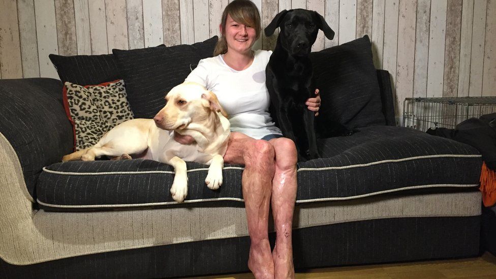 Laura Masters and her two Labrador dogs Rex and Bella