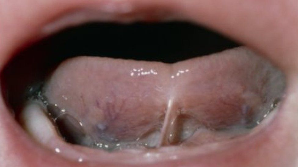 Close-up of a baby's mouth