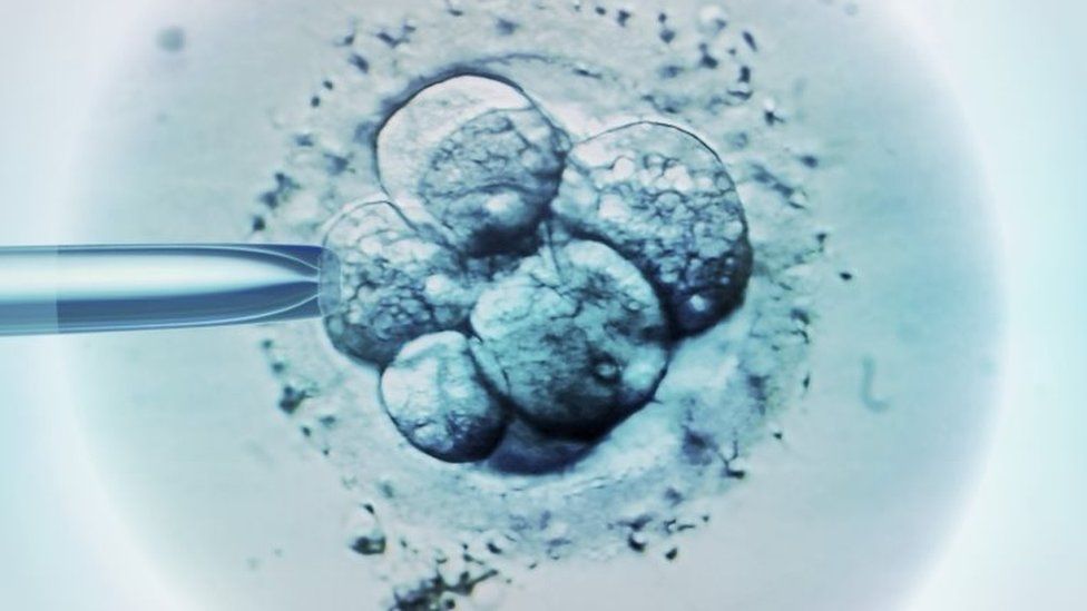 IVF embryo selection