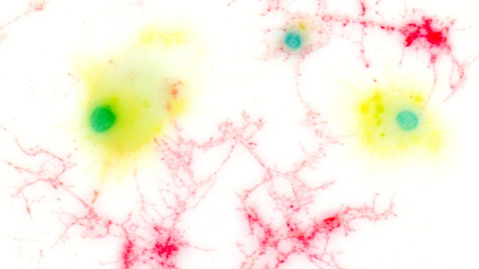 Microglia are immune cells present in the brain