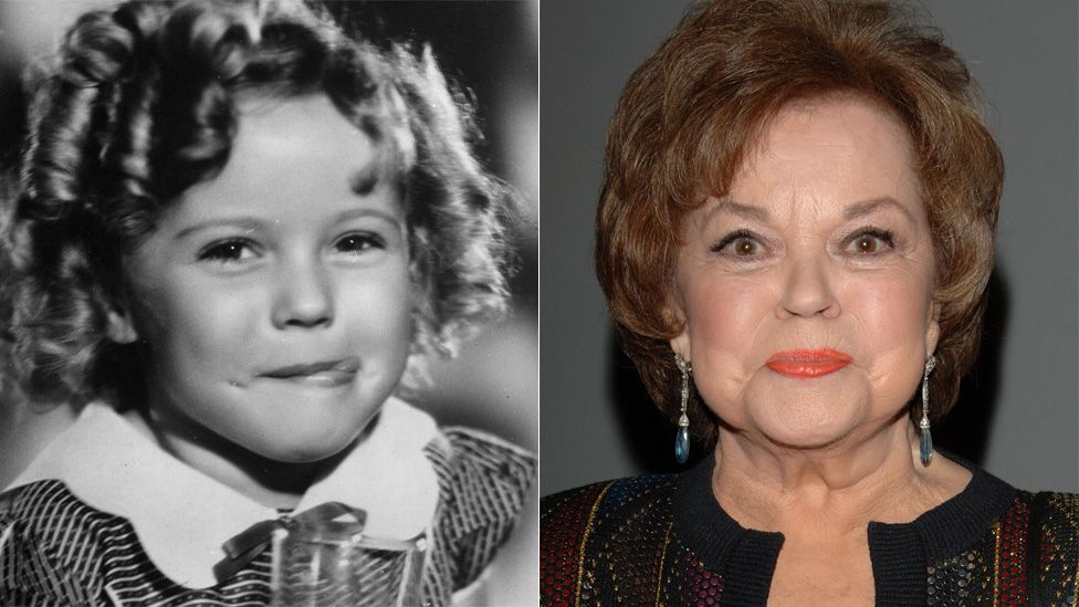 was shirley temple abused