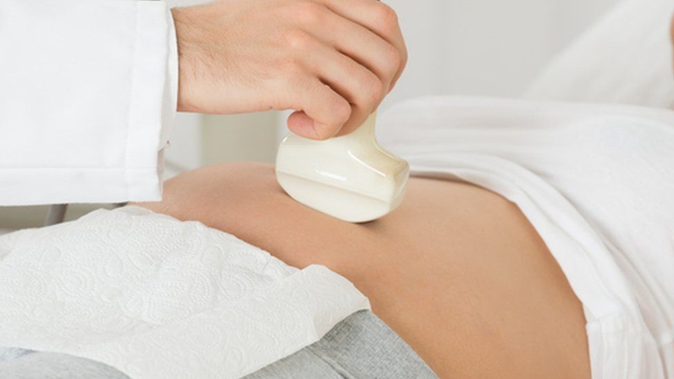 Ultrasound scan in pregnancy