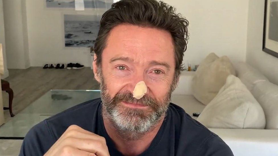 Hugh Jackman has new skin cancer scare, urges sun safety - BBC News