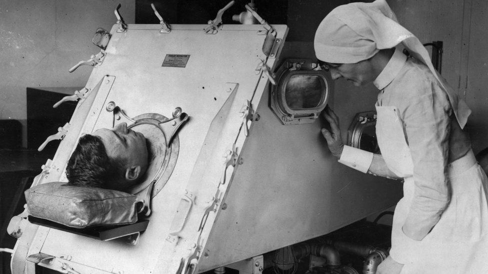 Patient in an iron lung being checked by a nurse