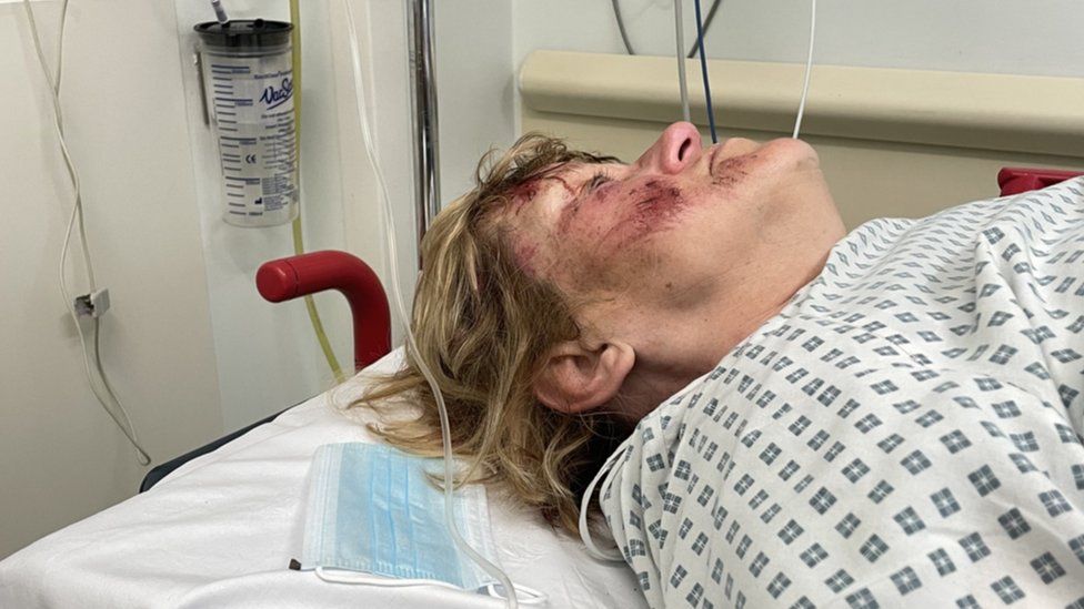 Julie Symondson in hospital after her fall