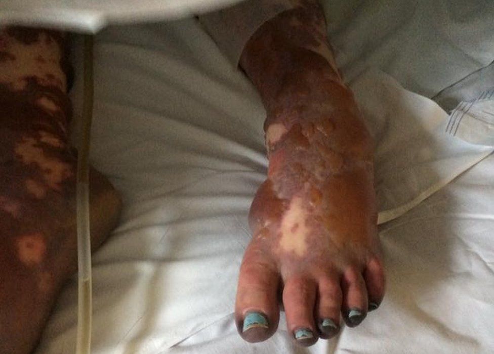 Charlene Colechin's foot