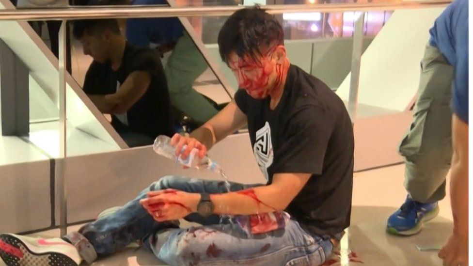 Protester injured during mob attack 21 July