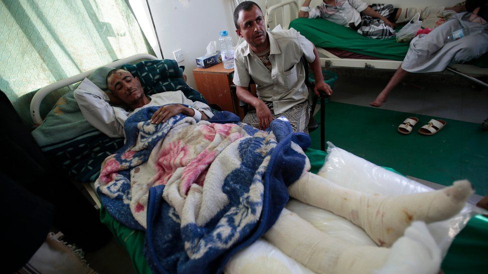 A man lies in a hospital bed after he was injured in an attack that hit a funeral hall packed with thousands of mourners, in Sanaa, Yemen