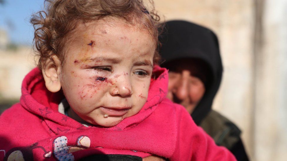 A woman holds up a child injured by a missile attack on a camp for displaced people in Idlib province, Syria (21 November 2019)