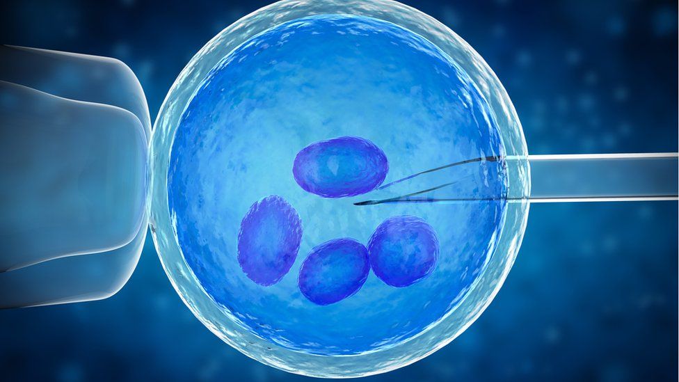 An illustration of IVF