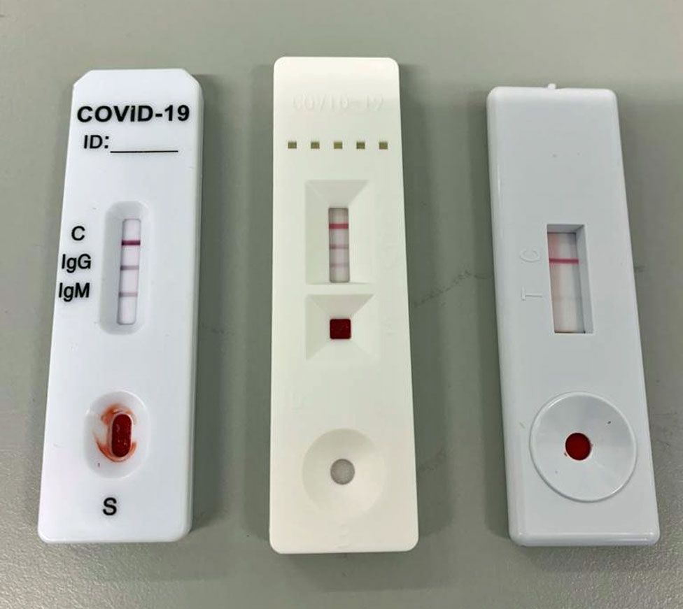 Collection 94+ Pictures photos of positive covid test results Full HD, 2k, 4k