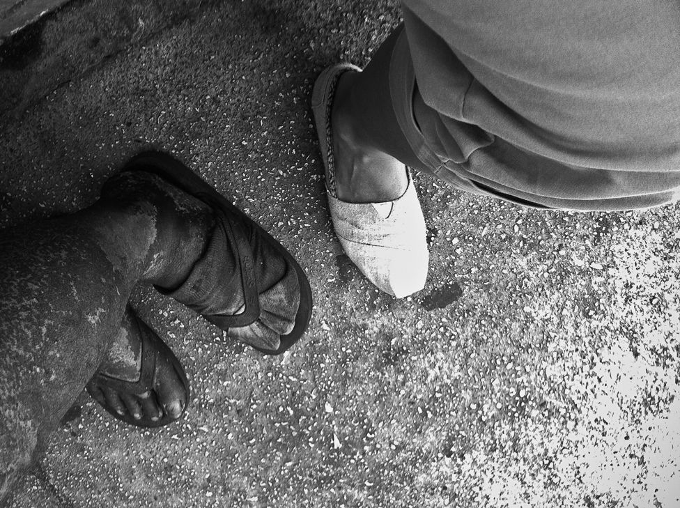 Diana Kim's father's feet, blackened by living on the streets in April 12, 2013