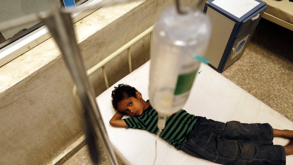 A Yemeni child infected with cholera receives treatment at a hospital in Sanaa (7 August 2017)