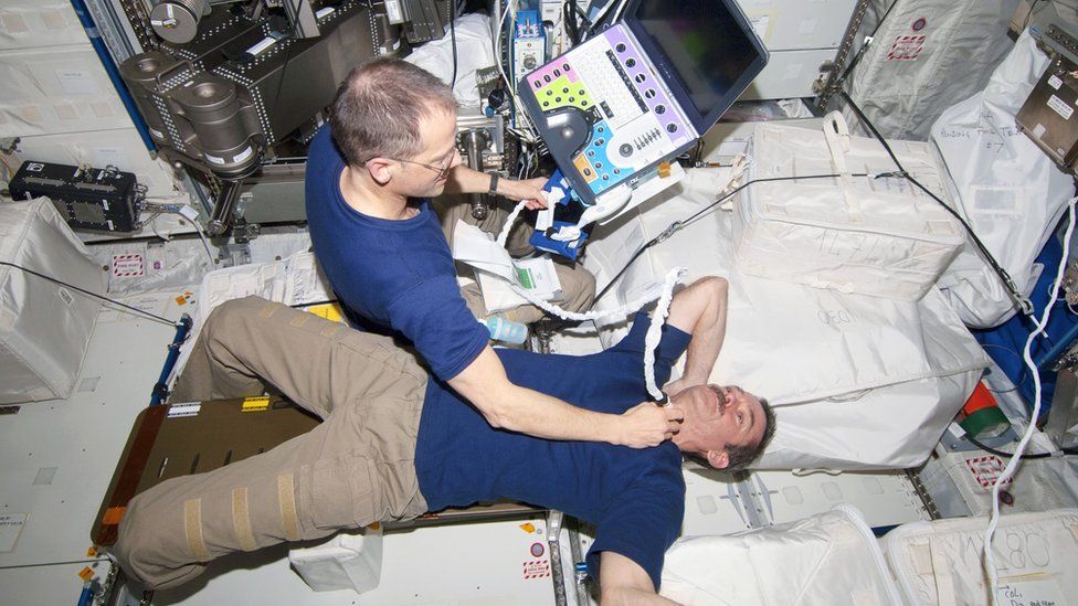 An ISS astronaut performing an ultrasound scan on Canadian astronaut Chris Hadfield on a previous mission