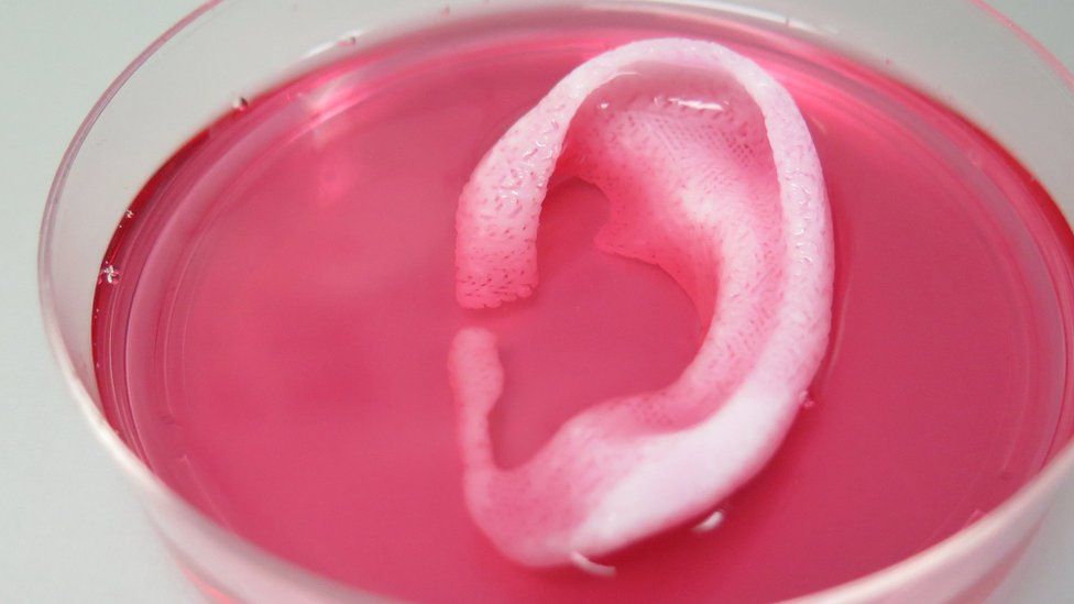 Doctors 3D-print body parts - News