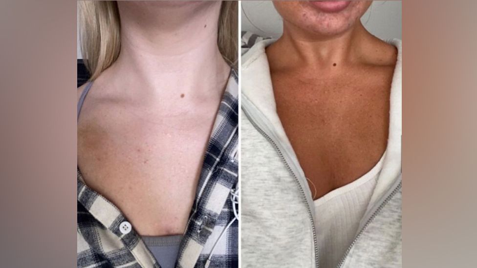 dangerous-tanning-products-promoted-by-influencers-bbc-news