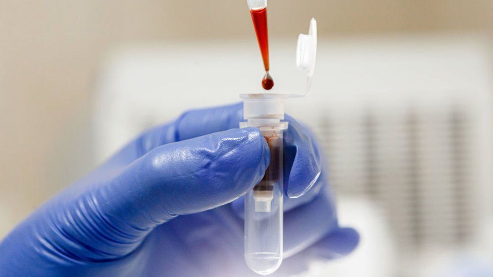File pic of blood test being carried out