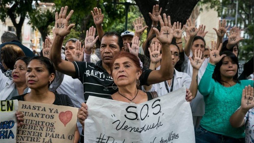 Hands of a protester depict the message "No more", as a group of people protest in front of the Jose Manuel de los Rios Children's Hospital claiming there is a lack transplants and medical treatments, in Caracas, Venezuela, 27 May 2019.