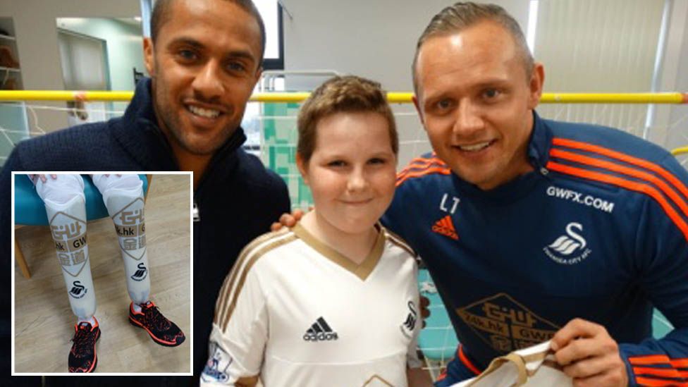 Callum with Wayne Routledge (l) and Lee Trundle (r) and his Swansea City branded prosthetic legs (inset)