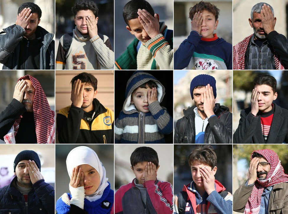 This combination of pictures created on December 19, 2017 shows Syrians covering one eye with their hands in the rebel-held town of Douma in Syria's besieged eastern Ghouta region, as part of a campaign in solidarity with a baby boy, Karim, who lost an eye, as well as his mother, in government shelling on the nearby town of Hamouria