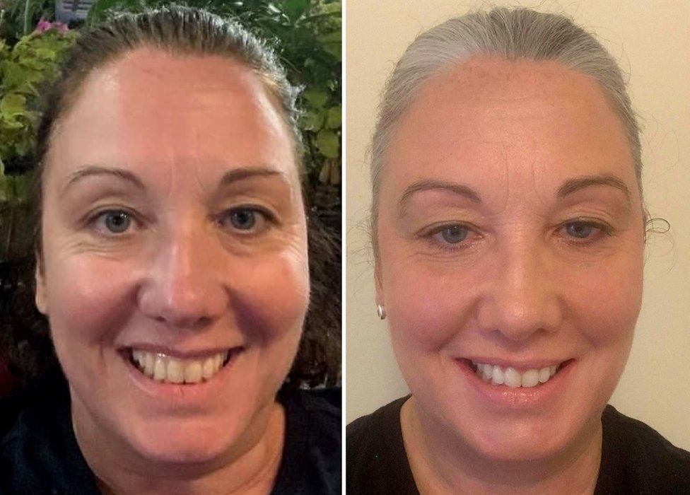 Ellen before and after