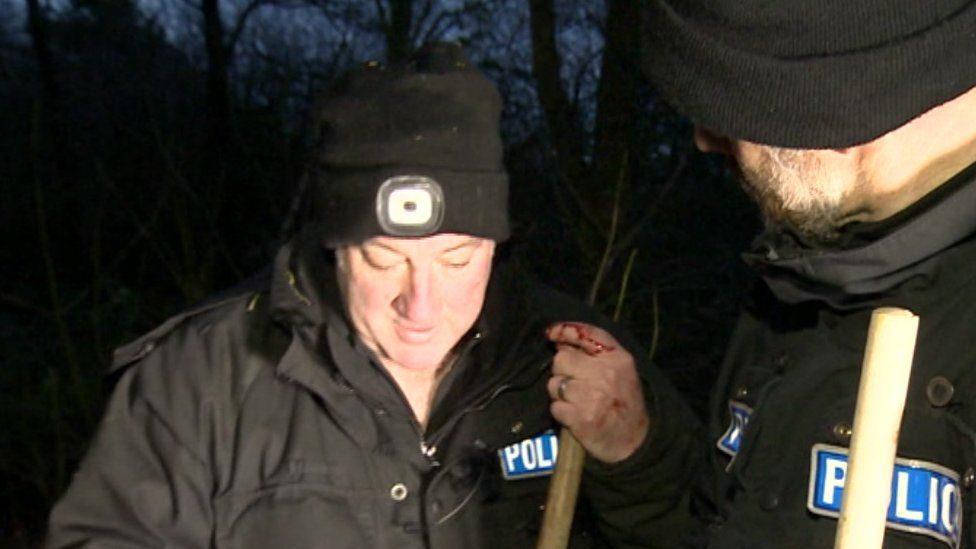 Officer with bleeding hands after searching through brambles for missing person